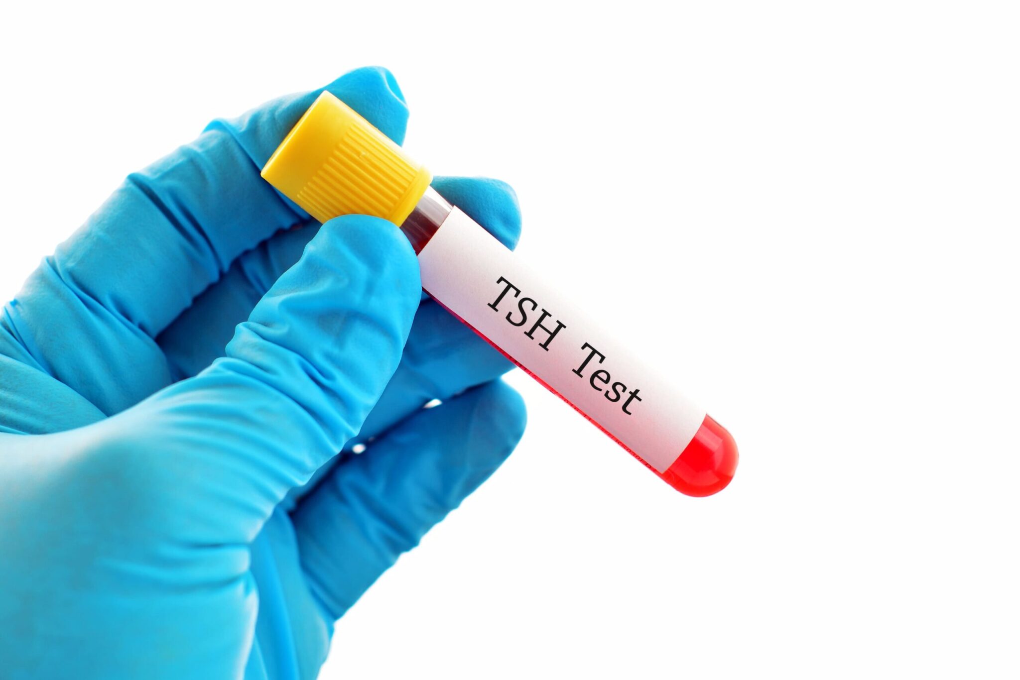 TSH-blood-test-tube