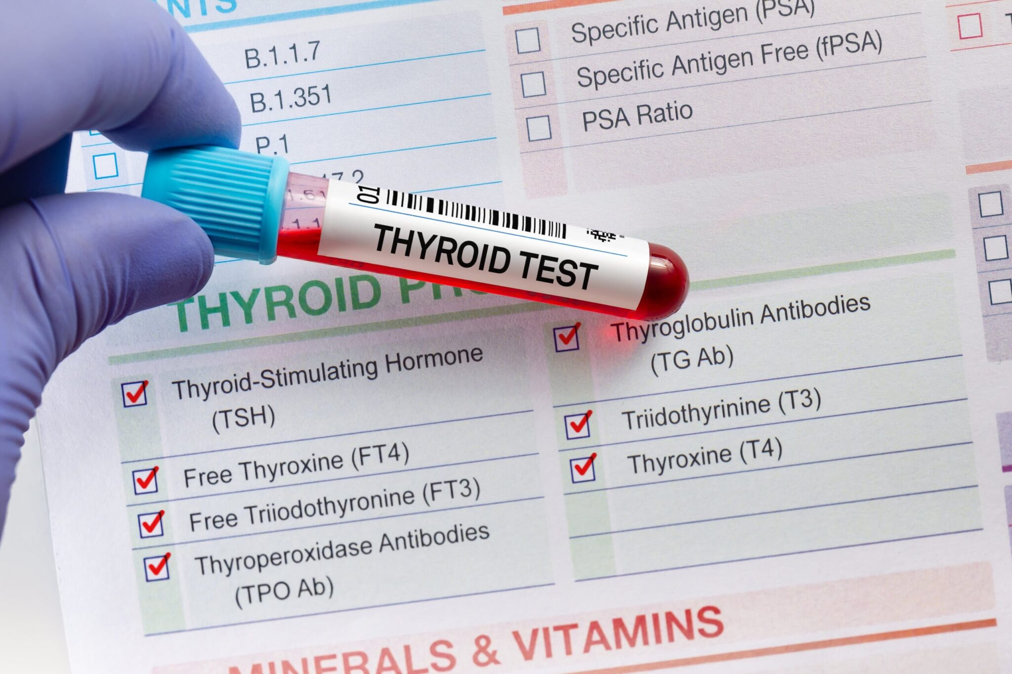 Thyroid and Metabolism Blood Tests