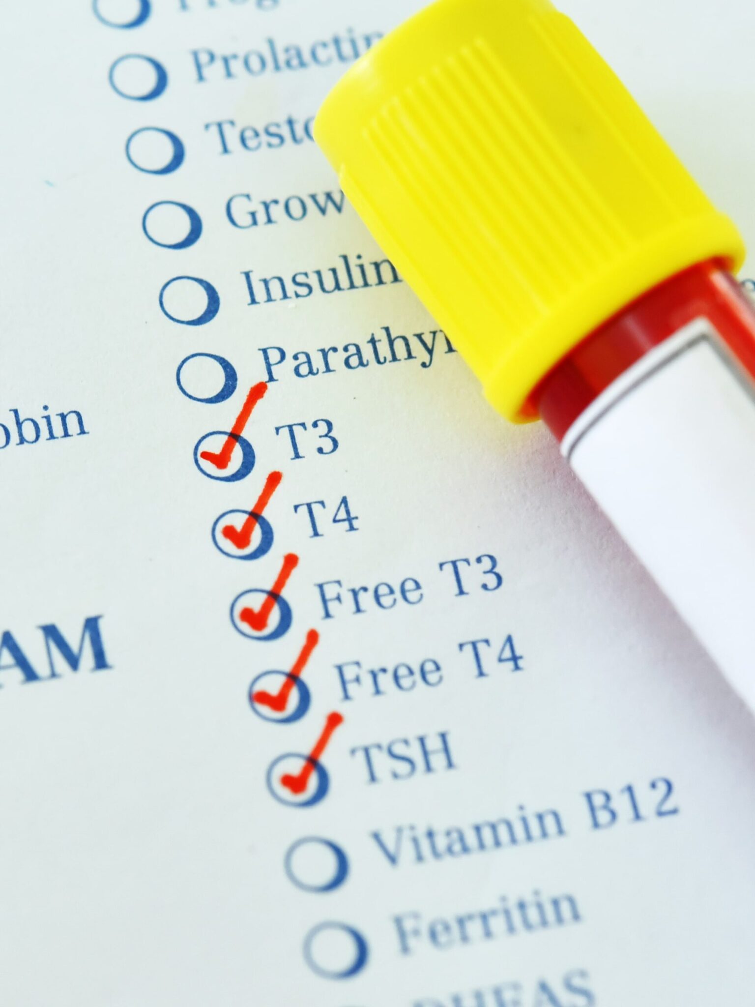at-home-t3-free-test