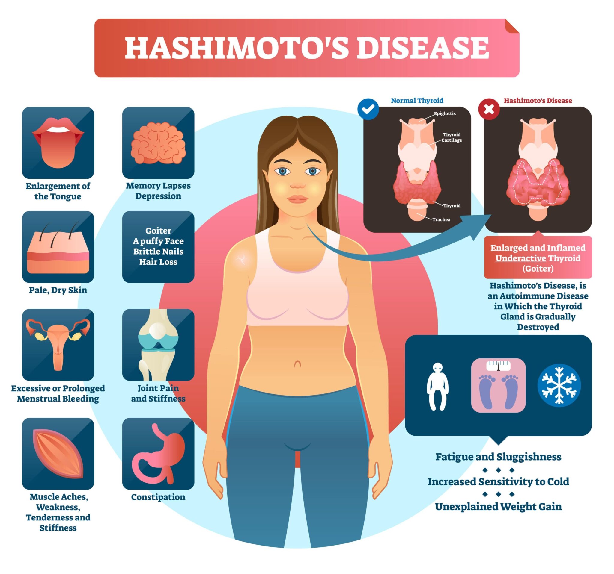 hashimotos-disease-health